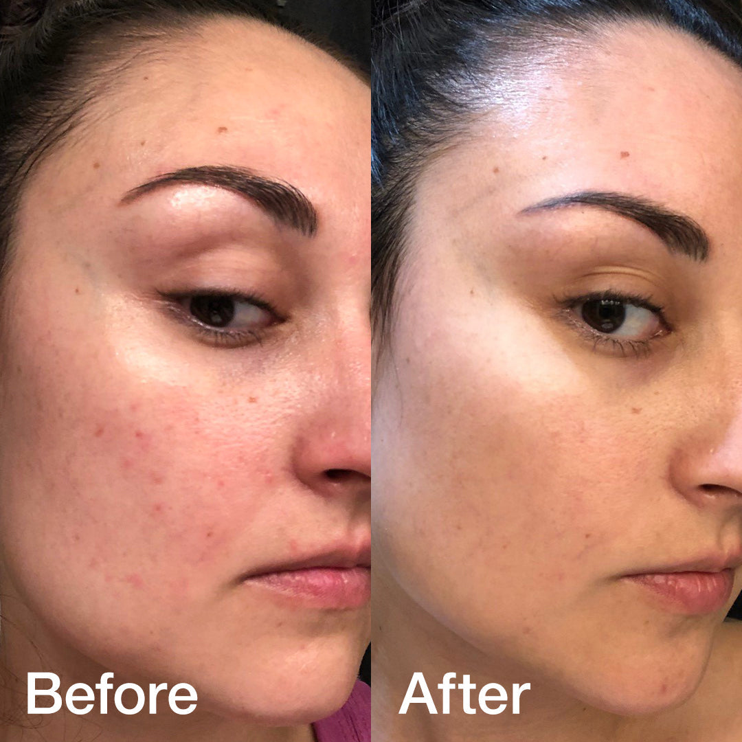 Glass Glow Duo with Gentle Everyday Skin Care