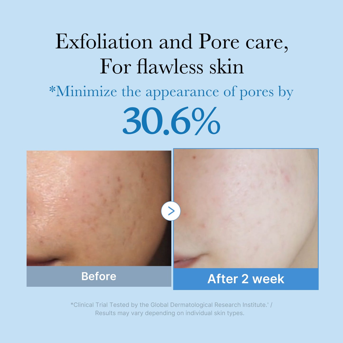 Zero Pore Toner for Lightweight Everyday Skin Prep