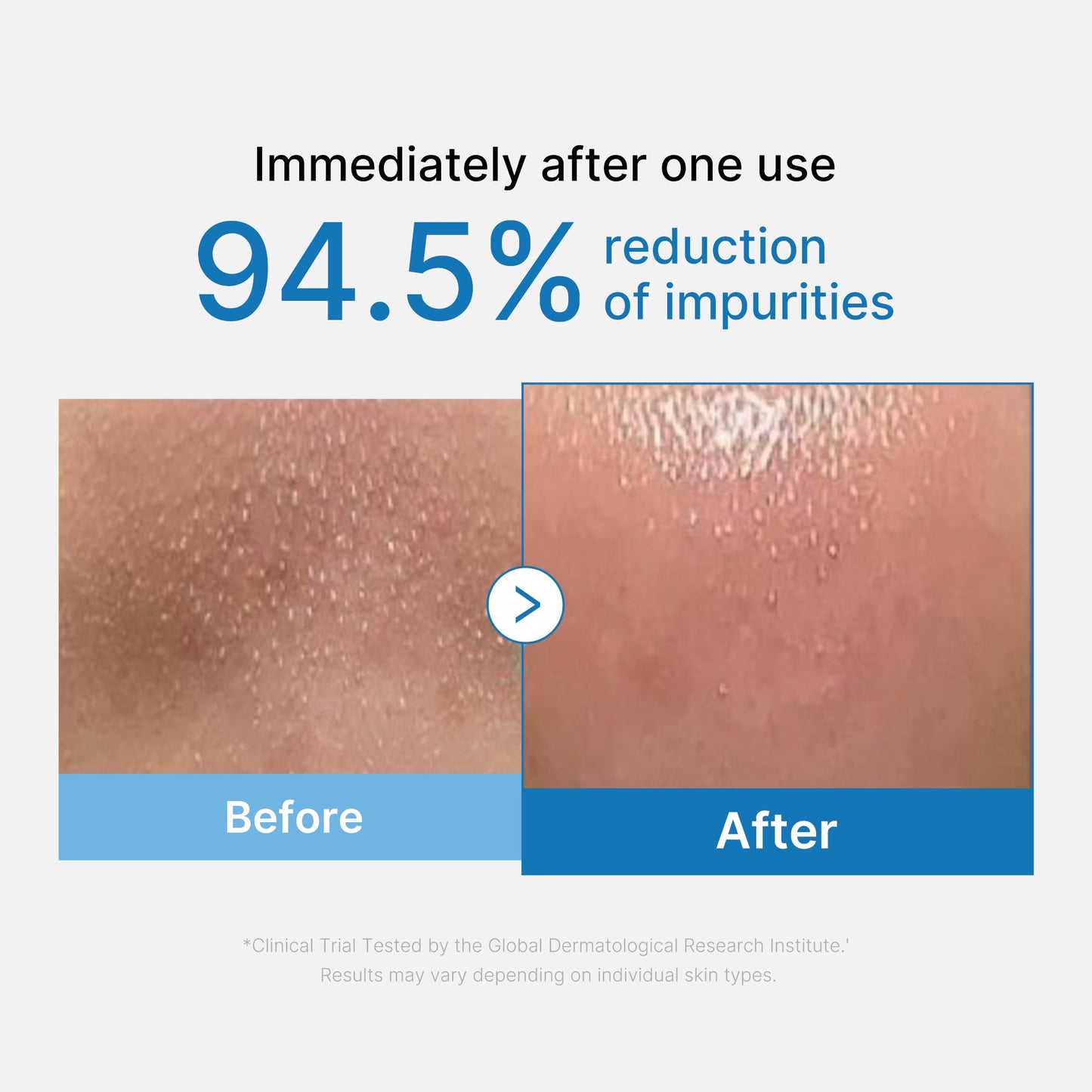 Zero Pore Blackhead Deep Cleansing Oil for Gentle Everyday Cleansing