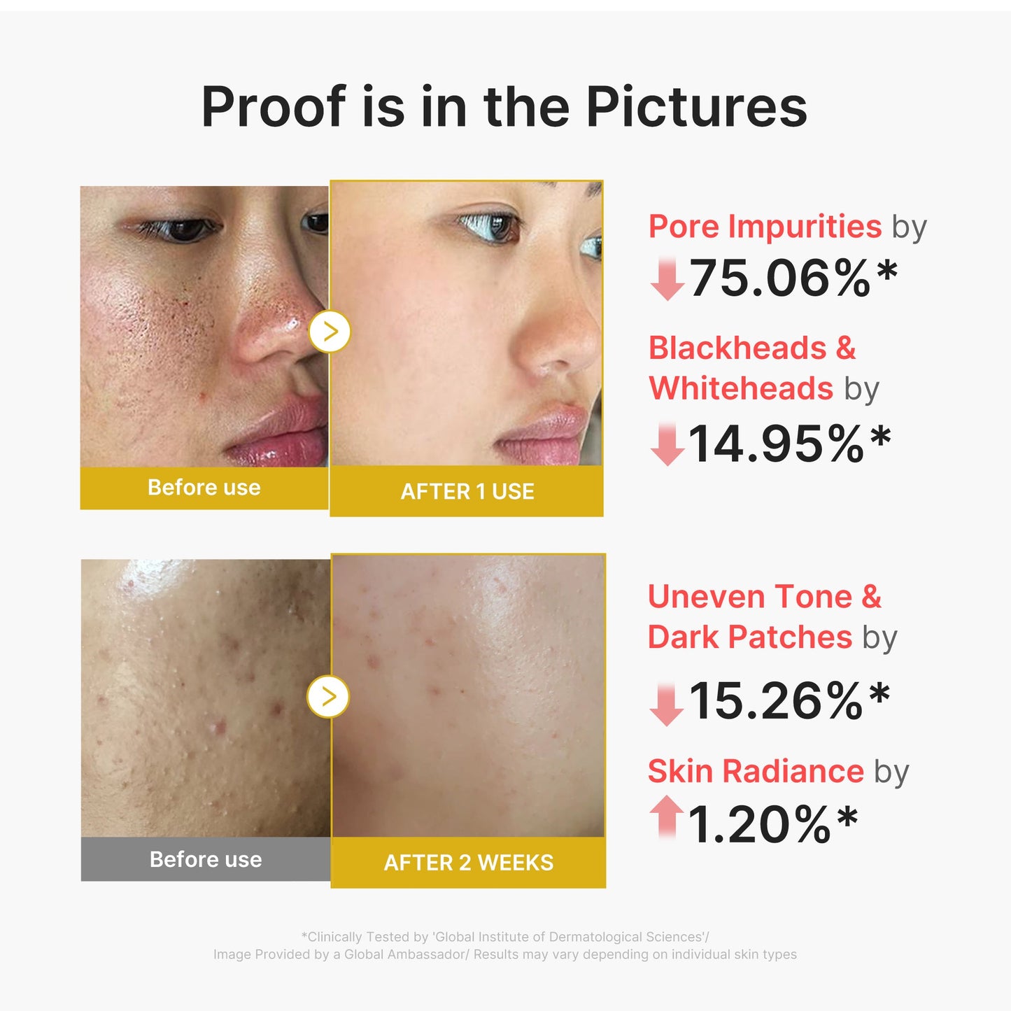 Kojic Acid Turmeric Peel Shot with Convenient At Home Skin Care
