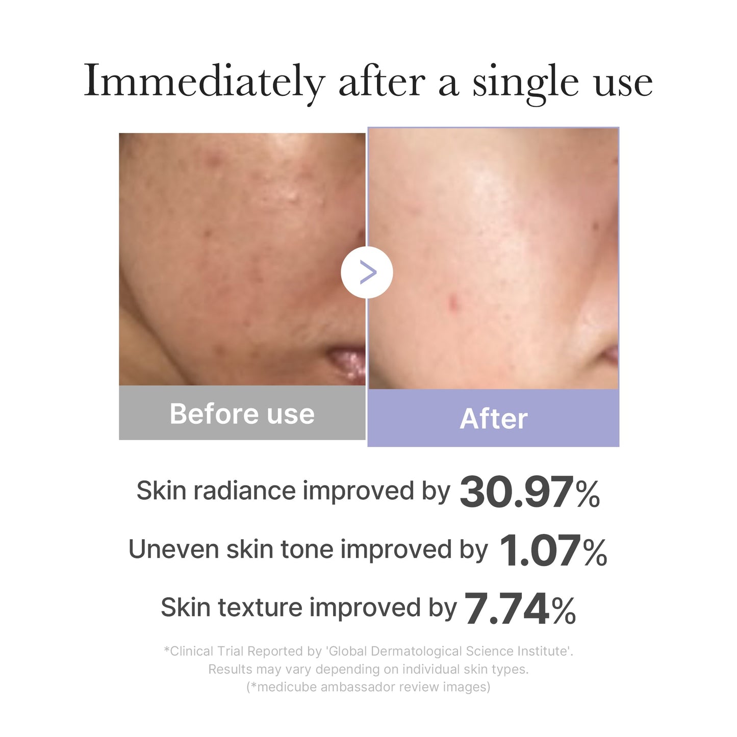 Mini Booster Pro for Convenient At Home Skin Care