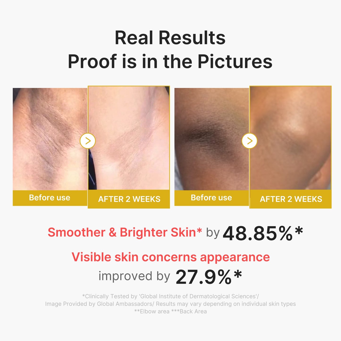 Kojic Acid Turmeric Body Peel Shot for Convenient At Home Skin Care