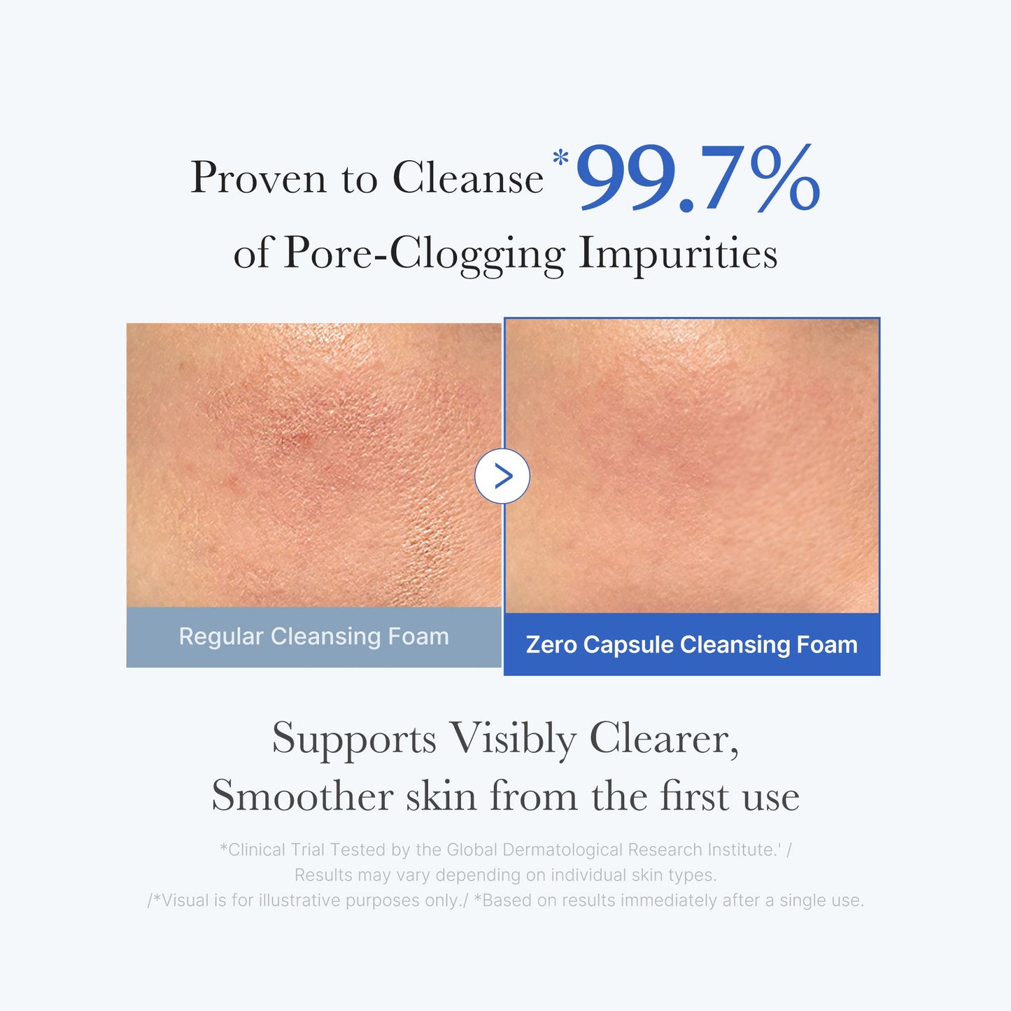 Zero Pore Capsule Cleansing Foam for Gentle Everyday Cleansing