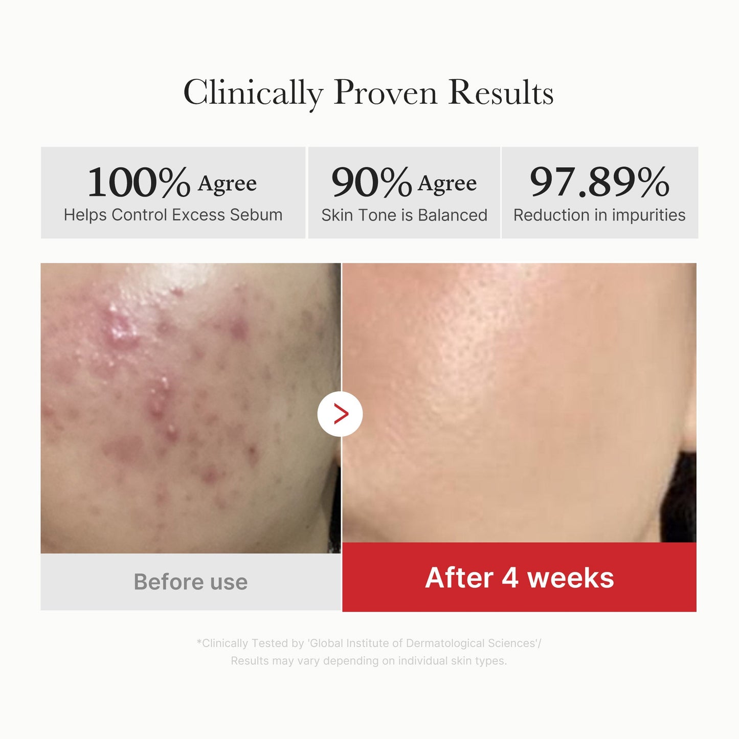 Red Succinic Acid Panthenol Pads for Gentle Daily Toning Care