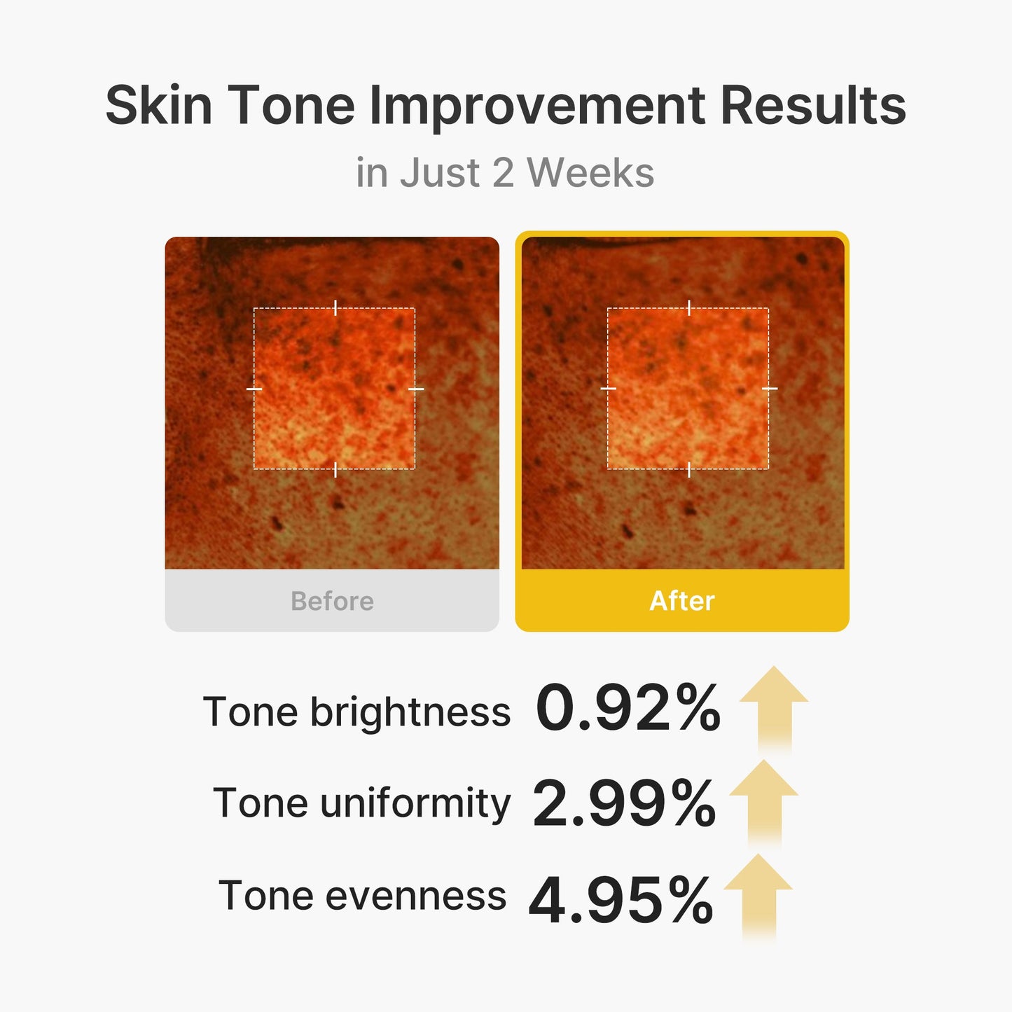 Kojic Acid Turmeric Vita Capsule Cream for Daily Moisture and Comfort Routine
