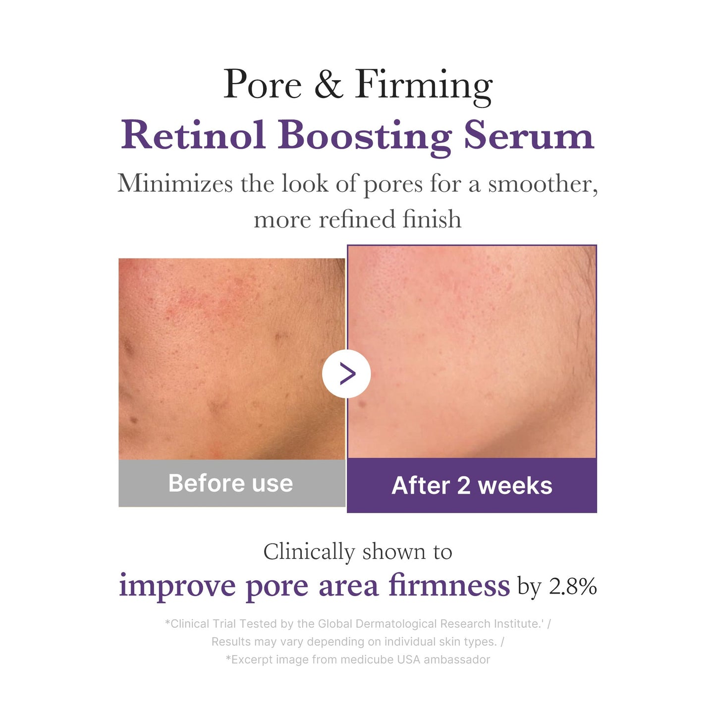Retinol NMN Boosting Serum with a Smooth Radiant Looking Finish