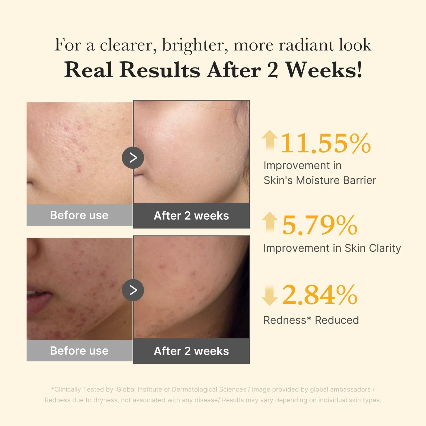 Kojic Acid Turmeric Capsule Serum for a Smooth Radiant Looking Finish