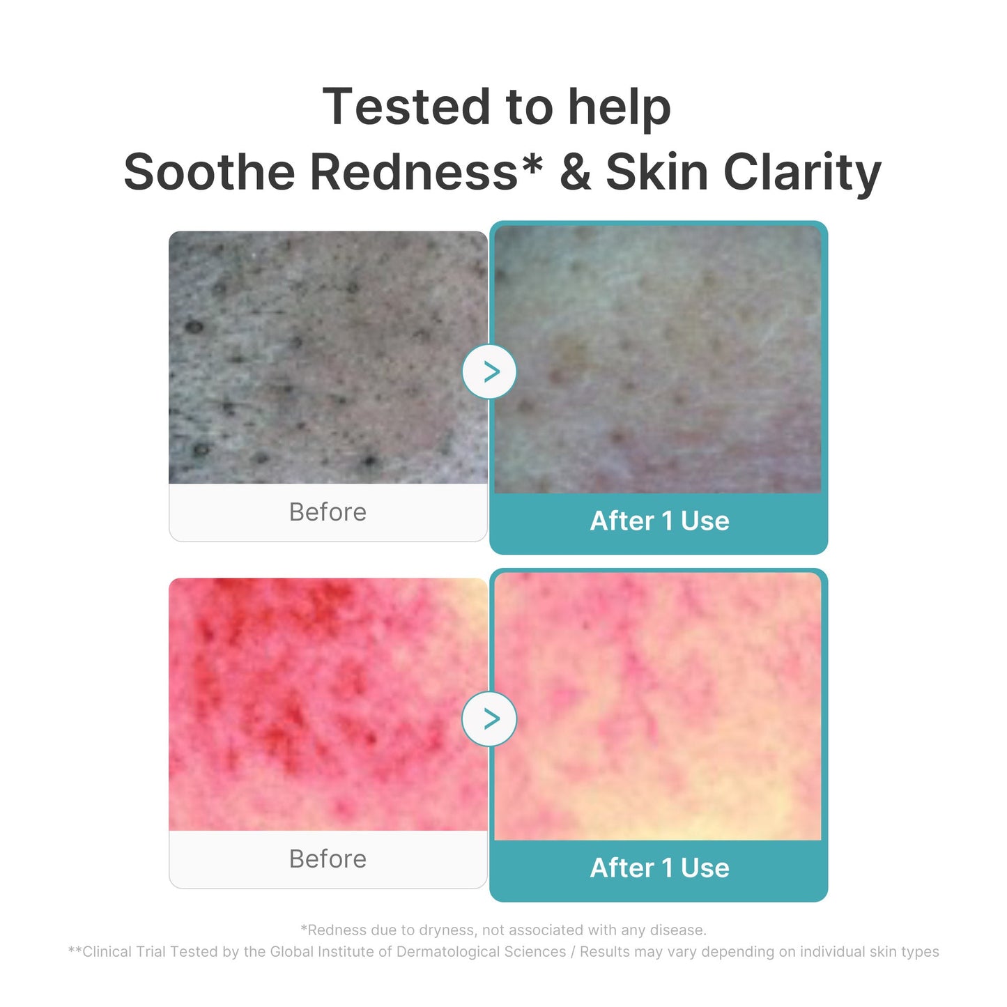 Azelaic Acid Capsule Foam Cleanser for Gentle Everyday Cleansing