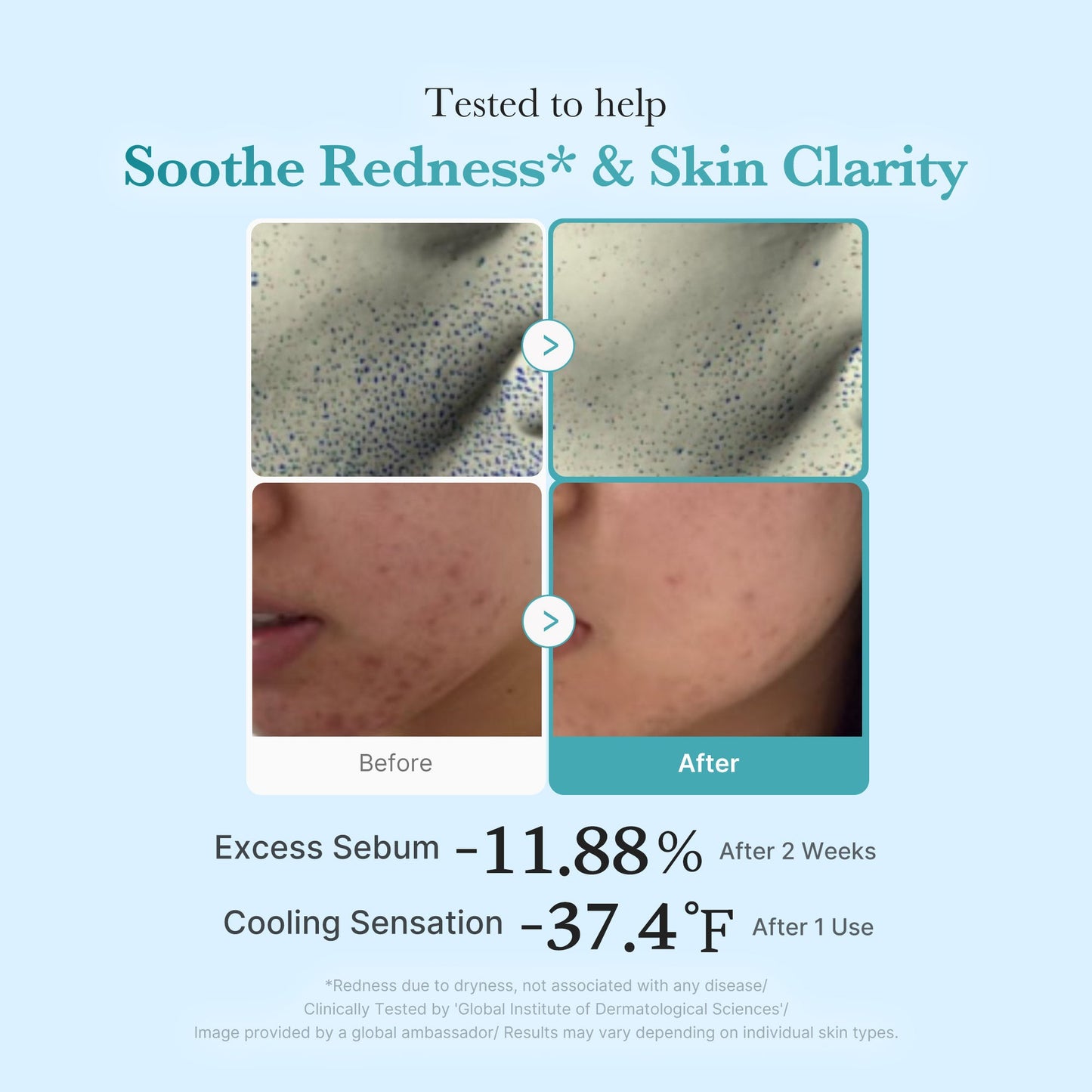 Azelaic Acid Niacinamide Clarifying Toner for Lightweight Everyday Skin Prep