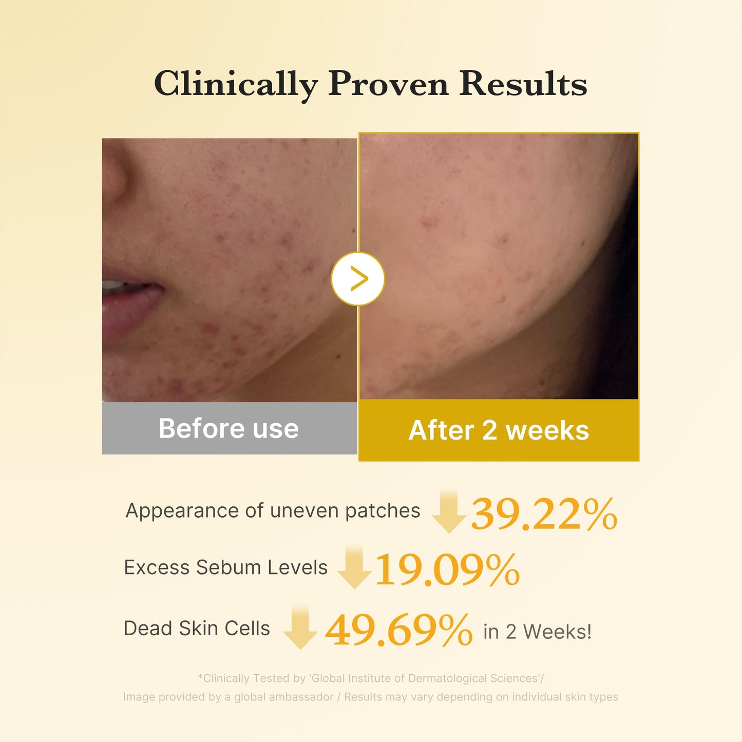 Kojic Acid Tumeric Toner Pad with Gentle Daily Toning Care