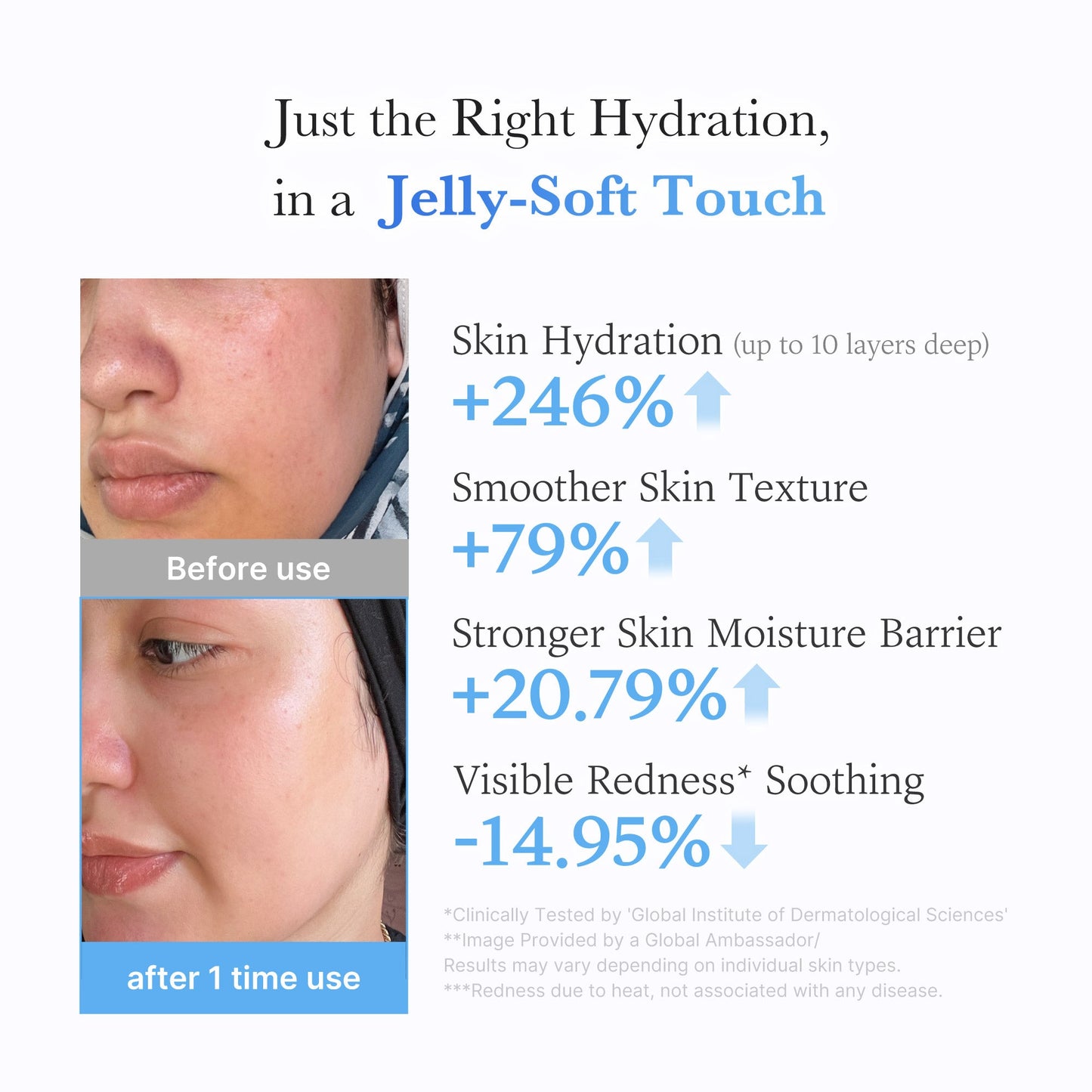 Hyaluronic Ceramide Moisturizing Jelly Cream for Everyday Moisture and Comfort Care