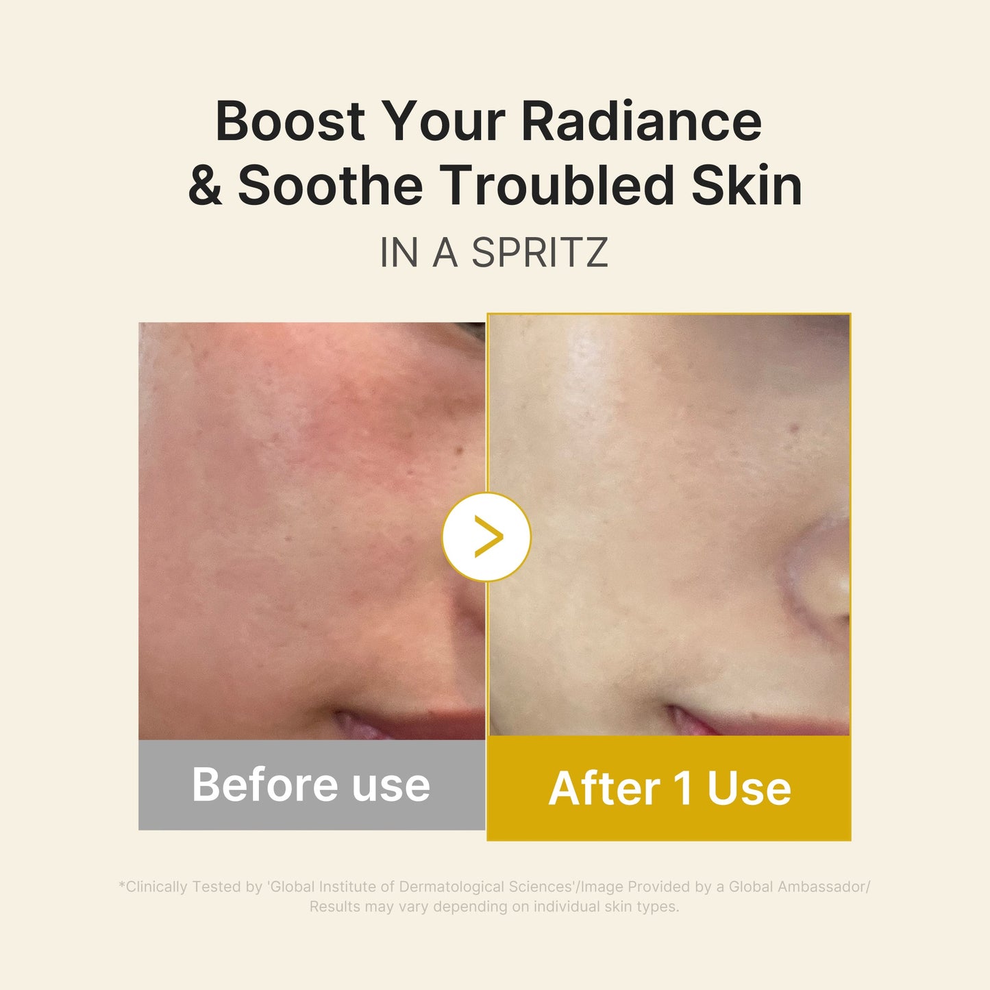 Kojic Acid Turmeric Vitamin Gold Jelly Mist Serum for Lightweight Everyday Skin Prep