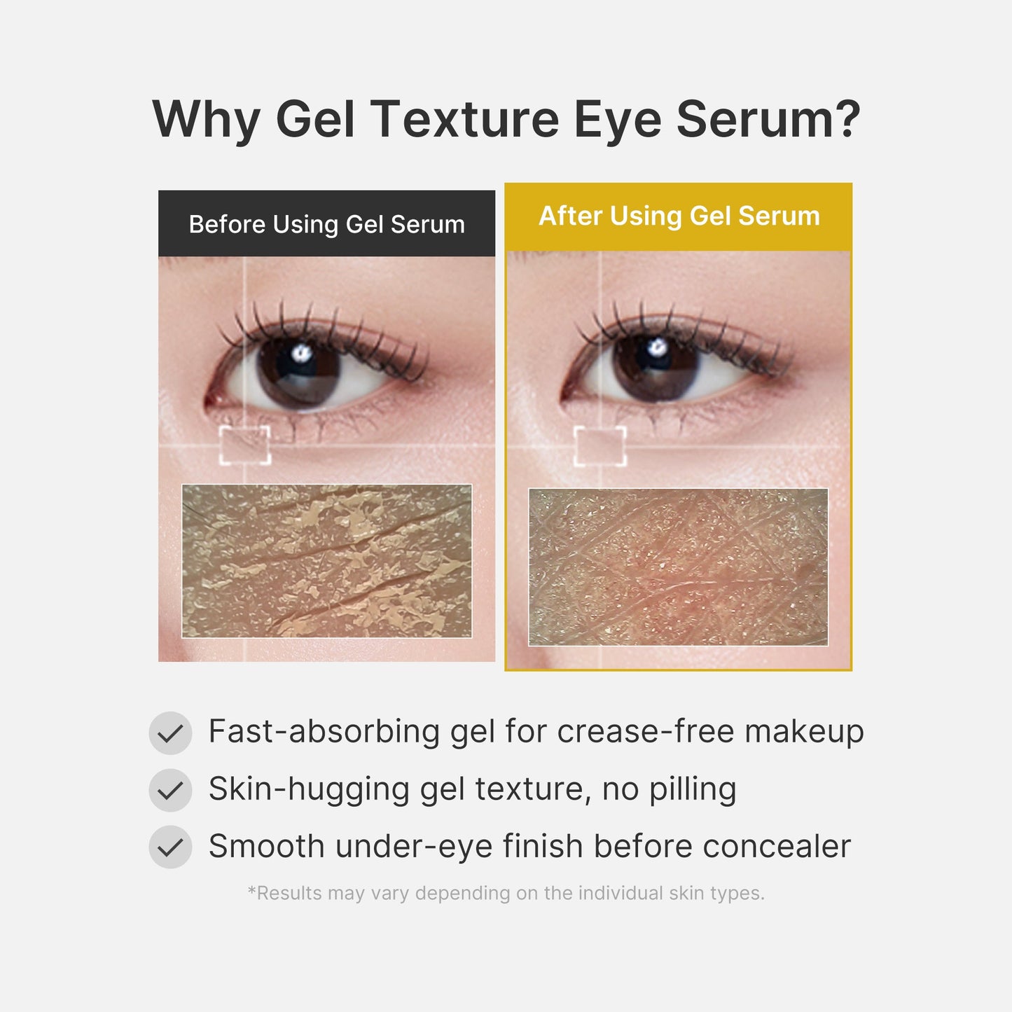 Kojic Acid Tumeric Eye Gel Serum for a Smooth Radiant Looking Finish