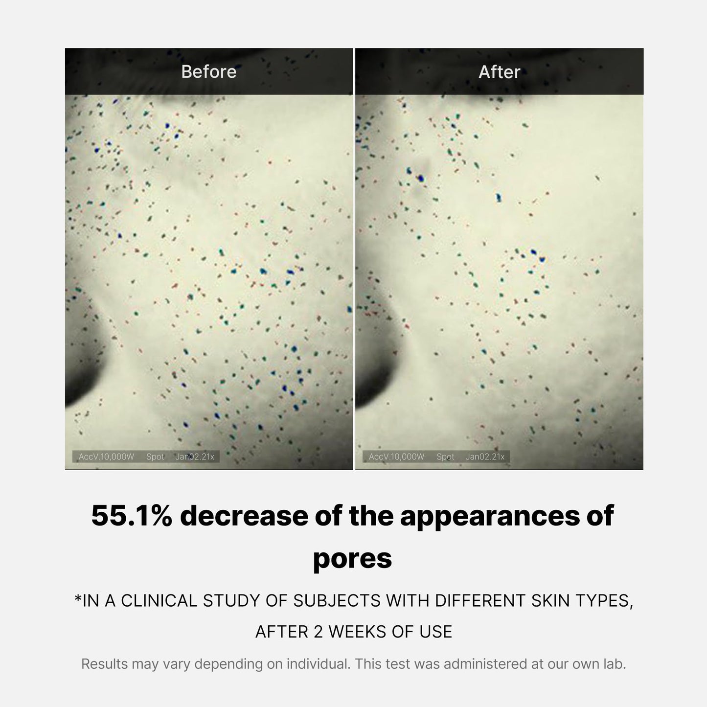 Zero Pore Daily Cream for Daily Moisture and Comfort Routine
