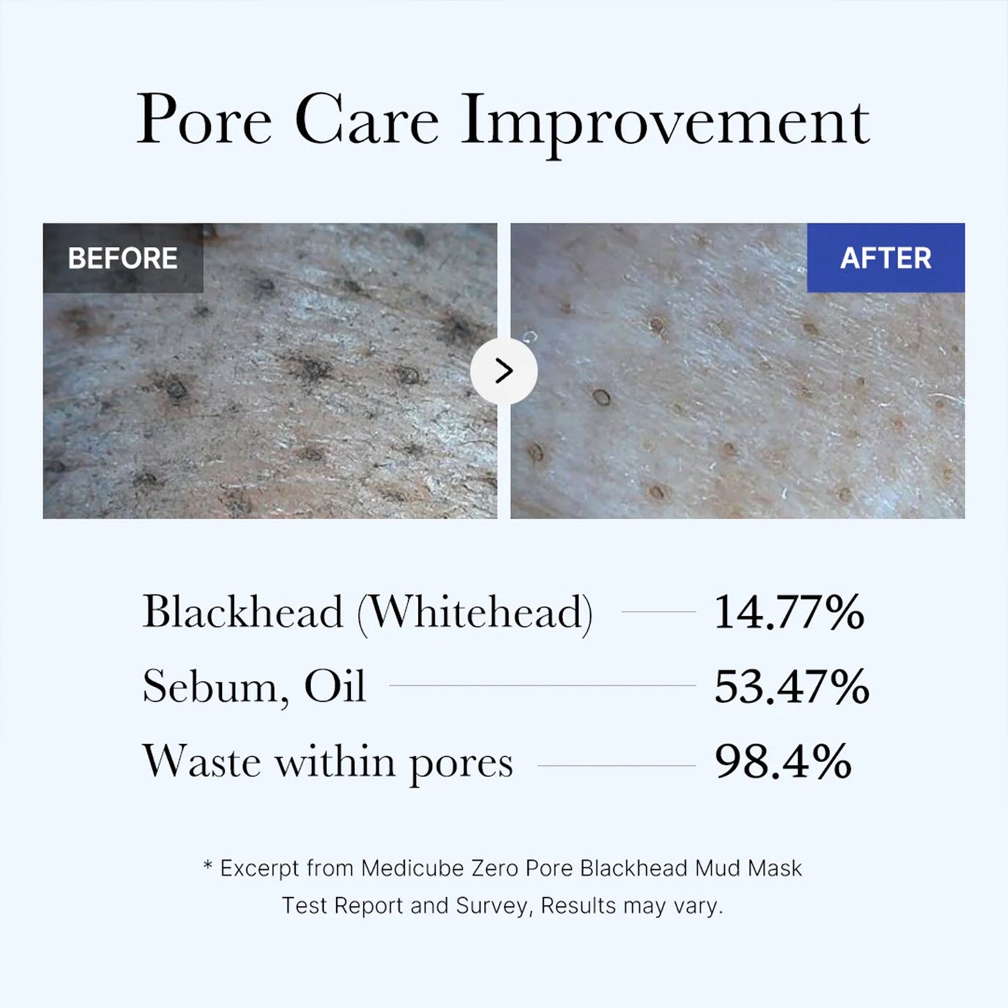 Zero Pore Blackhead Mud Mask with Weekly Moisture Focused Care