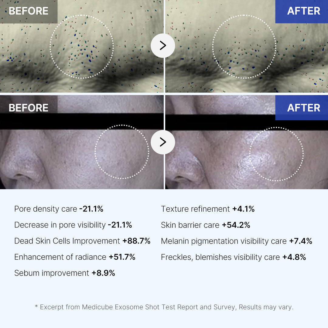 Zero Exosome Shot for Convenient At Home Skin Care