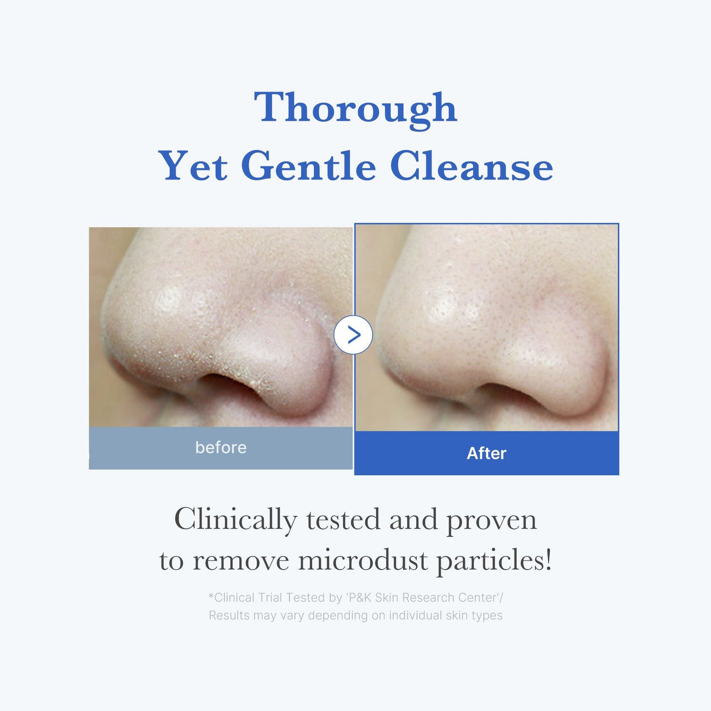 Zero Foam Cleanser for Gentle Everyday Cleansing