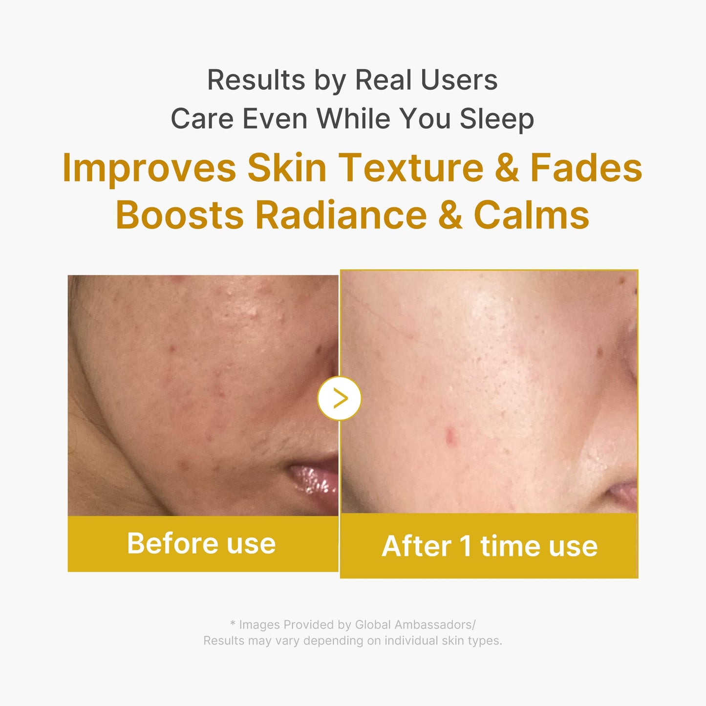 Kojic Acid Turmeric Overnight Wrapping Mask for Weekly Moisture Focused Routine
