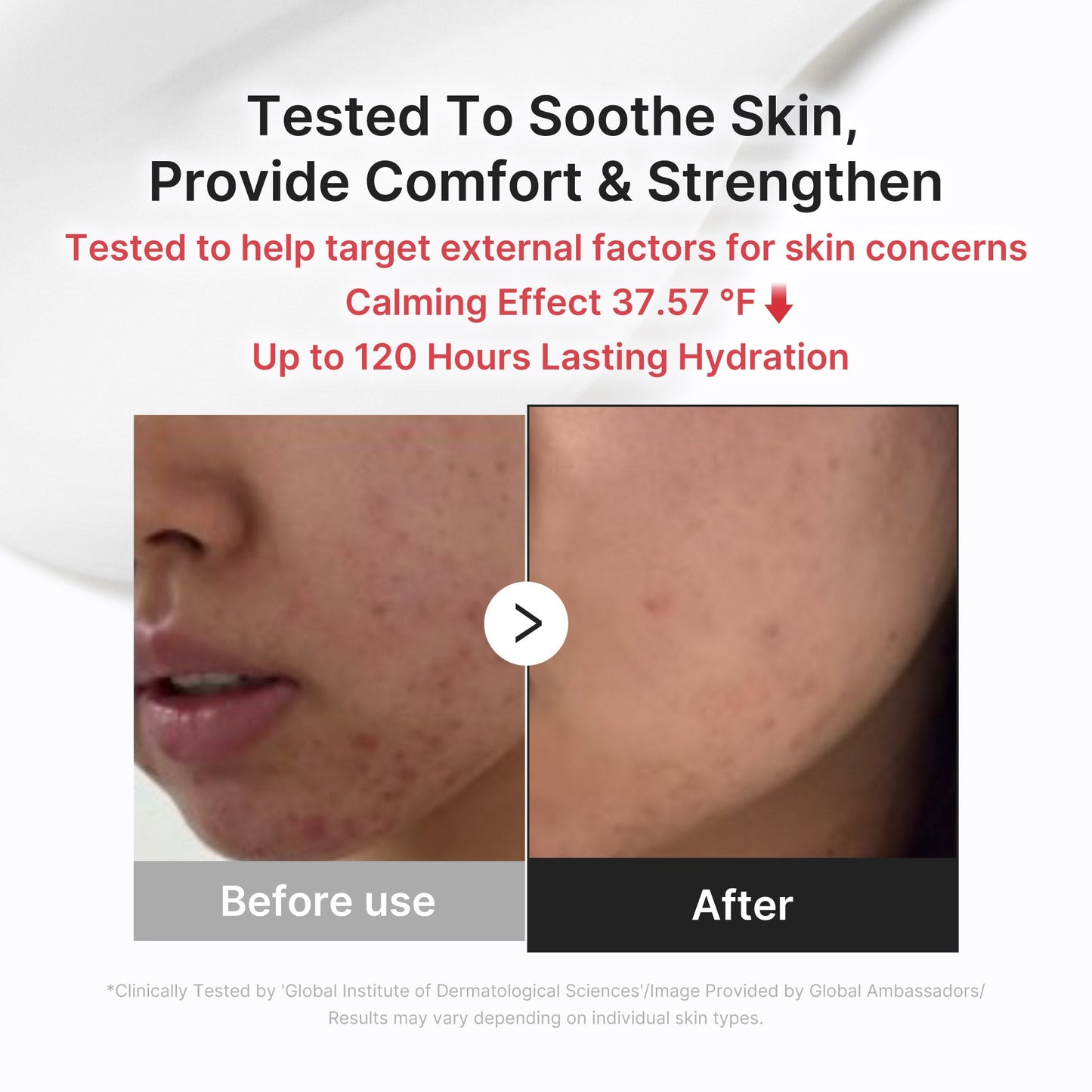 3H Daily Relief Cream for Daily Moisture and Comfort Care