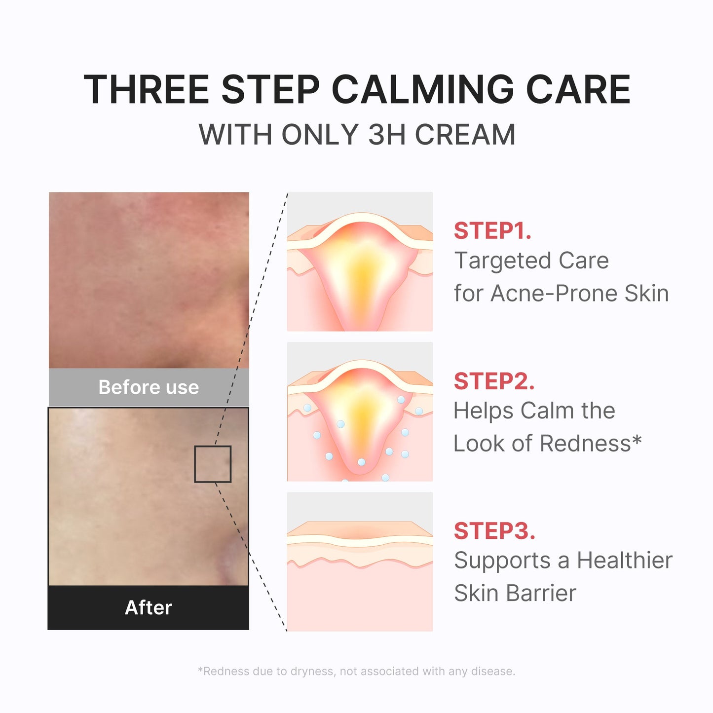 3H Daily Relief Cream for Daily Moisture and Comfort Care