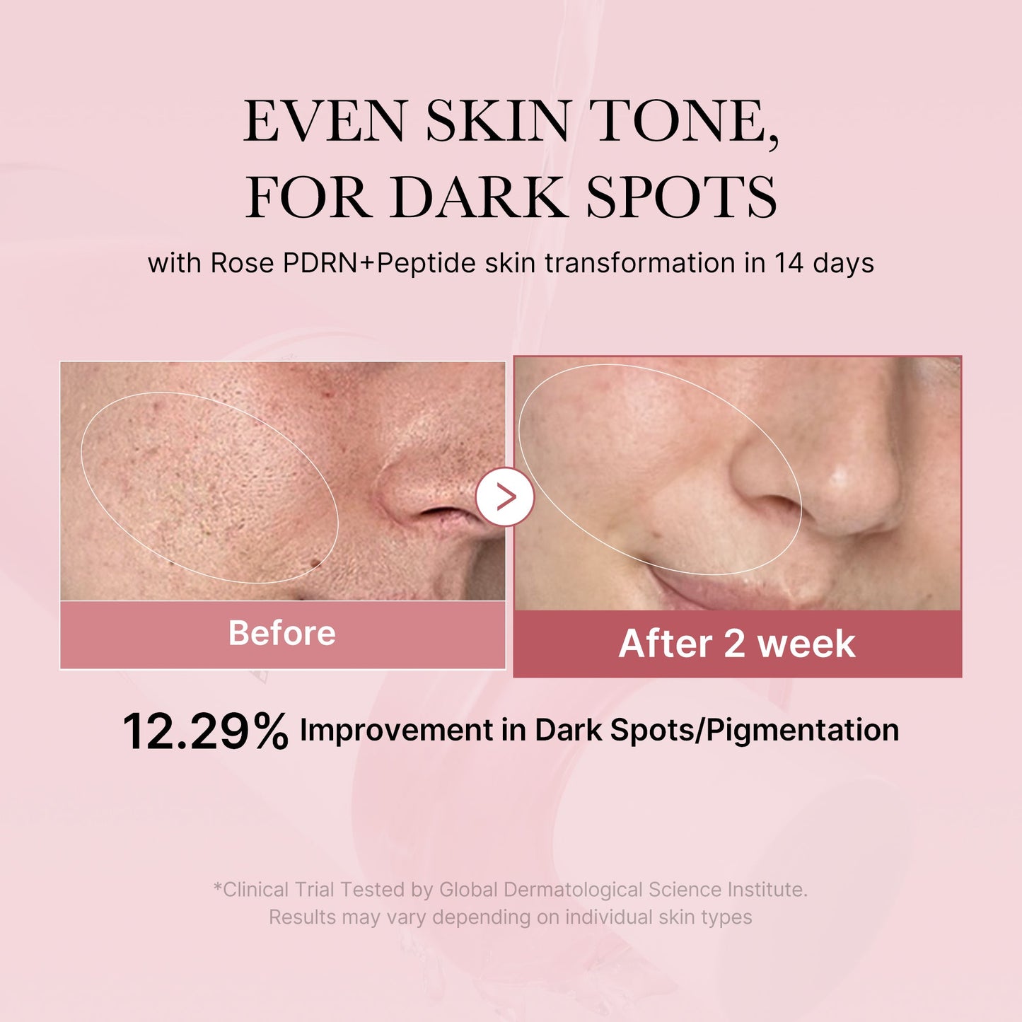 PDRN Pink Peptide Toner for Lightweight Daily Skin Prep
