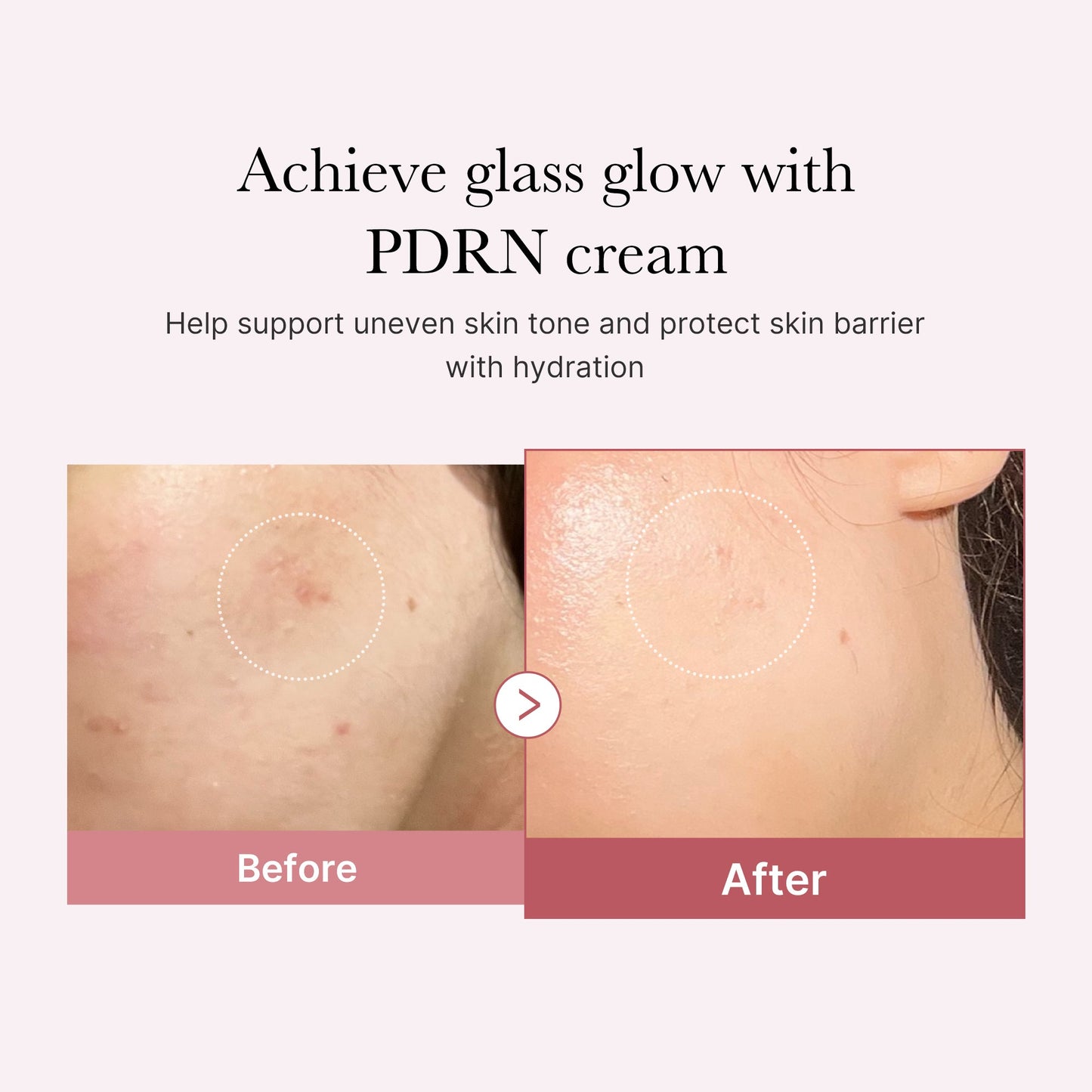 PDRN Pink Peptide Cream with Daily Moisture and Comfort Care
