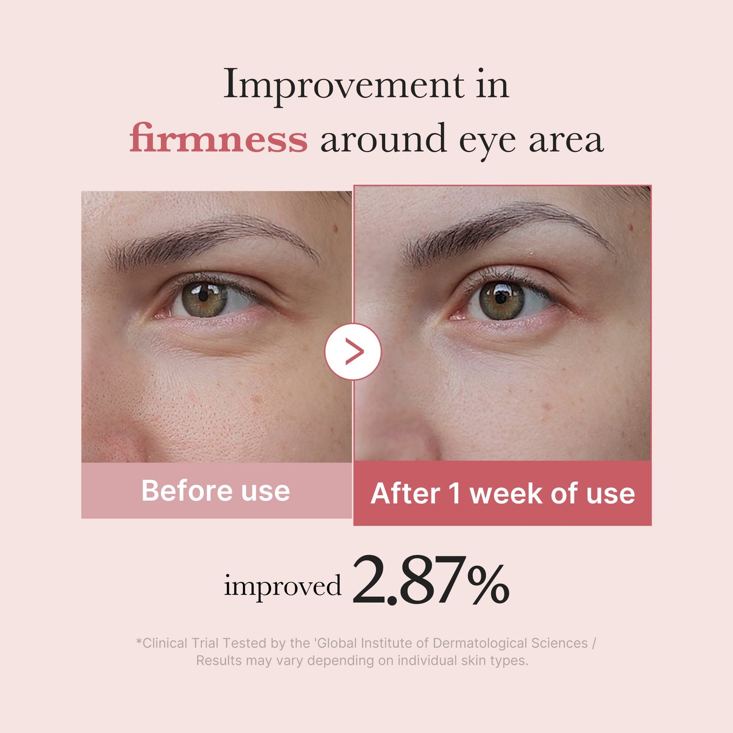 PDRN Pink Peptide Eye Cream with Gentle Daily Eye Area Care