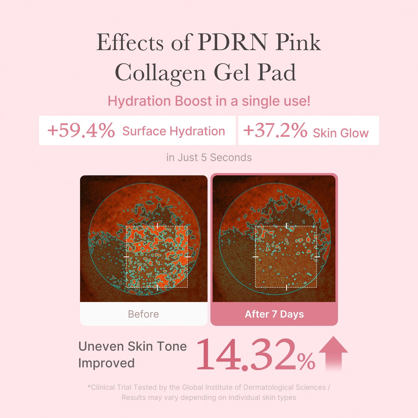 PDRN Pink Collagen Gel Toner Pad for Gentle Daily Toning Care