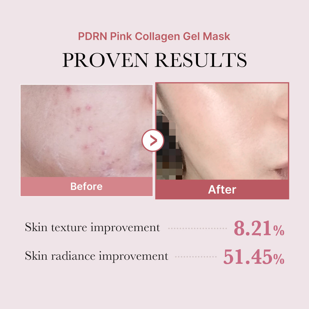Salmon PDRN Pink Collagen Jelly Gel Mask for Weekly Moisture Focused Routine