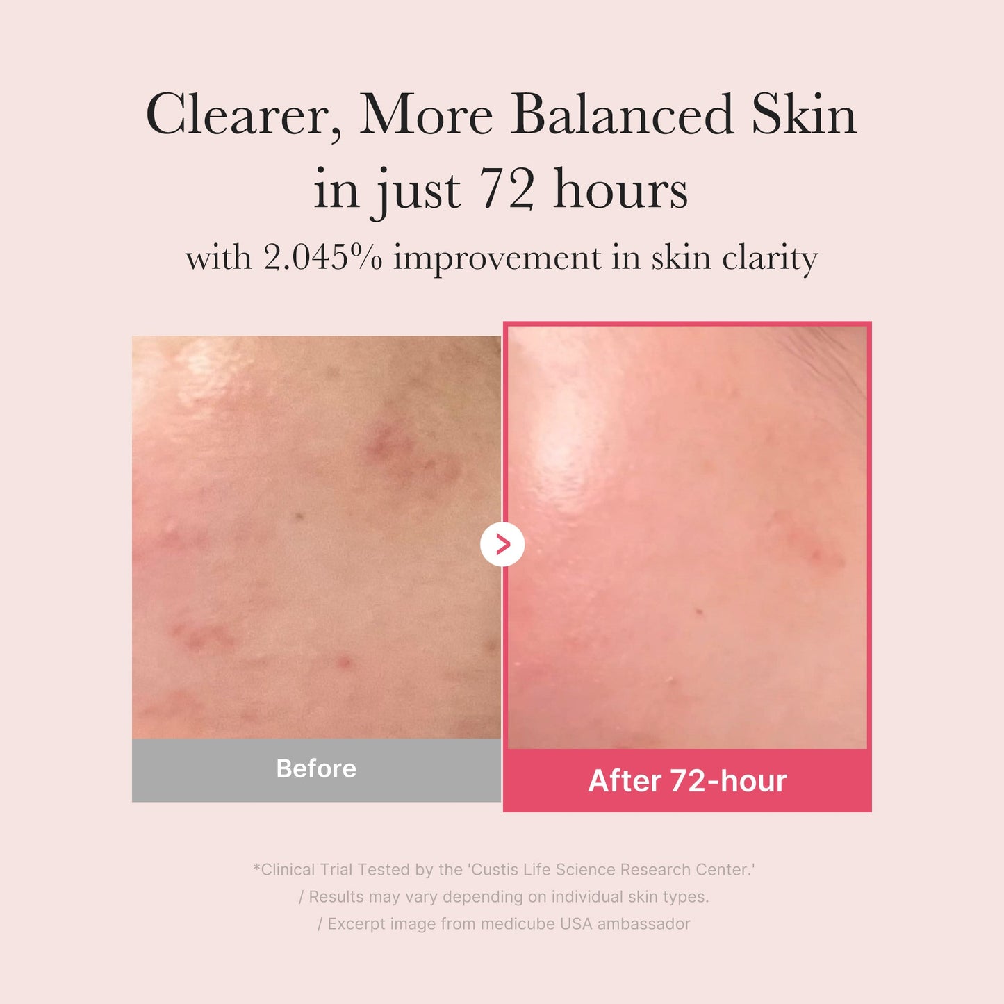 TXA Niacinamide Serum for a Smooth Radiant Looking Finish