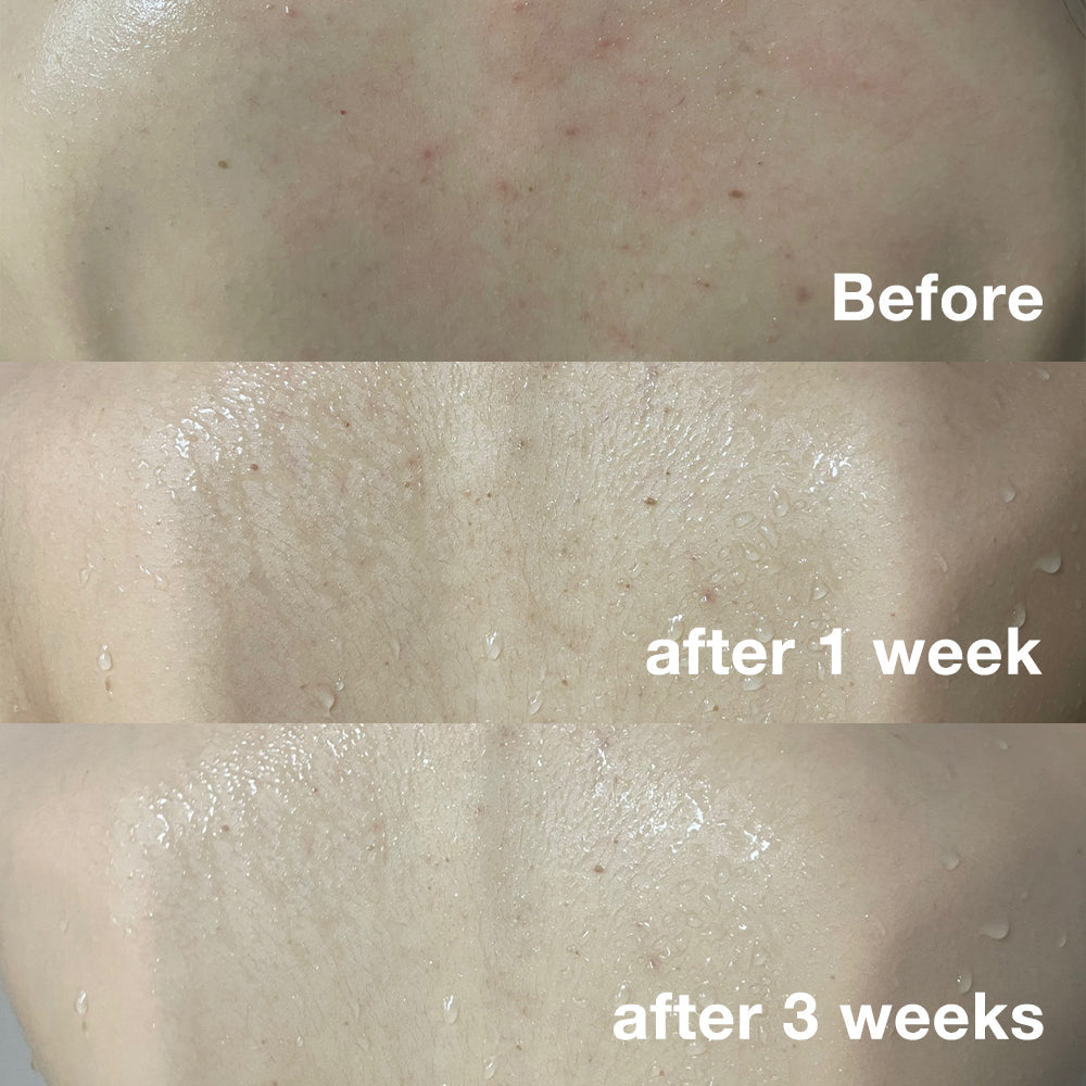 Red Body Wash for Gentle Everyday Cleansing
